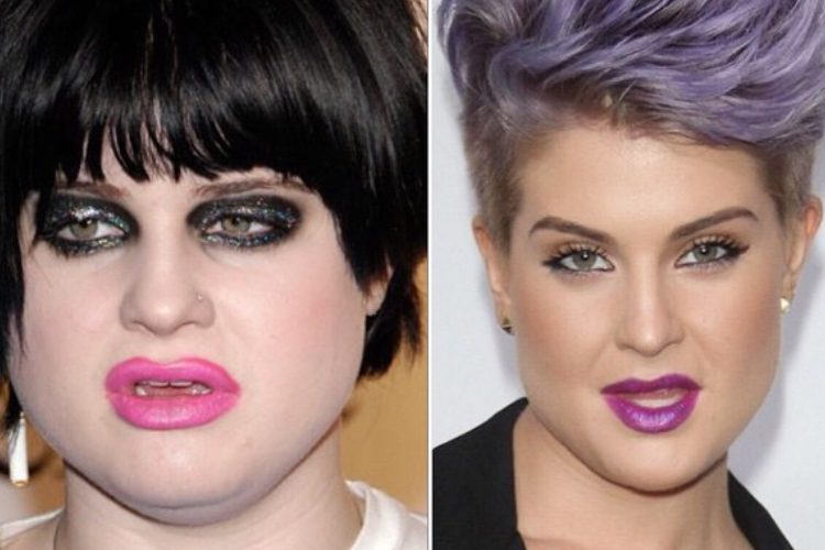 kelly osbourne figlia cantante ozzy prima e dopo