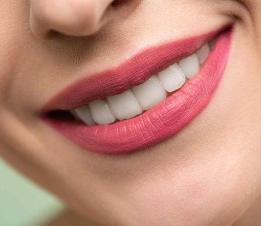 Sorriso