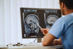 scoperta contro il tumore al cervello