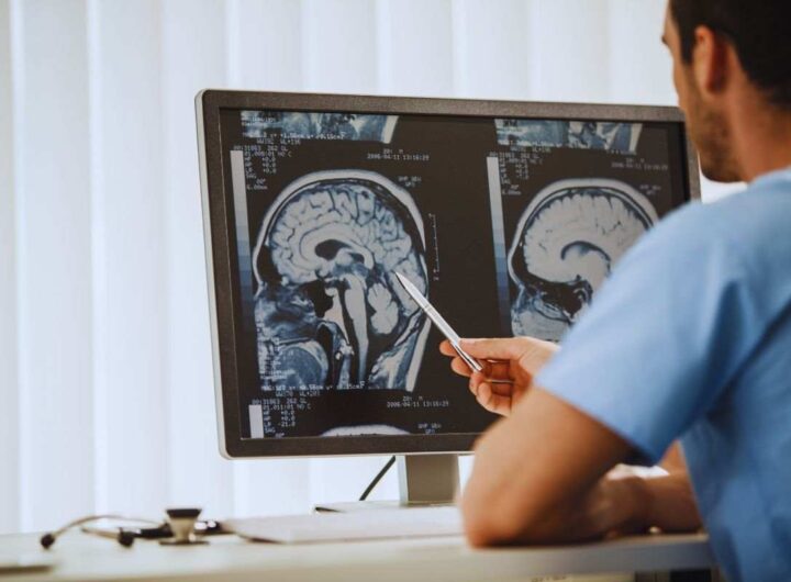 scoperta contro il tumore al cervello