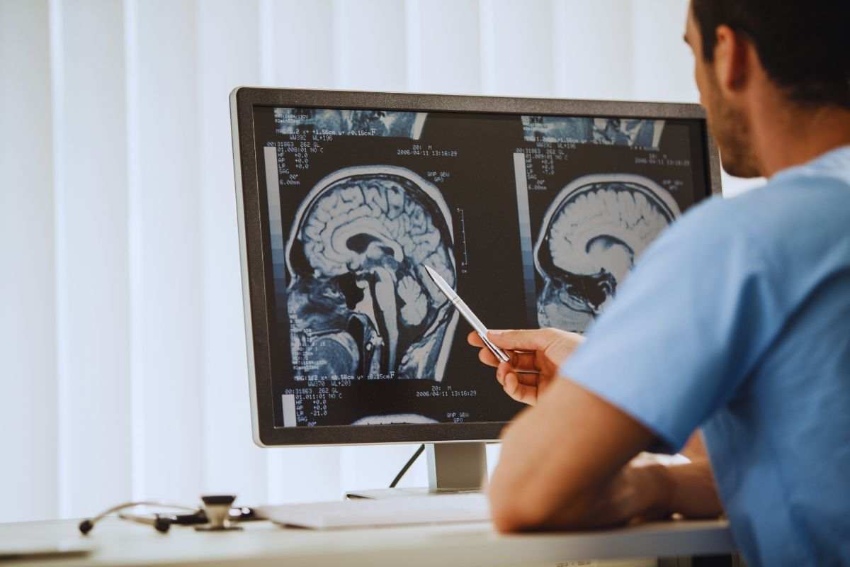 scoperta contro il tumore al cervello